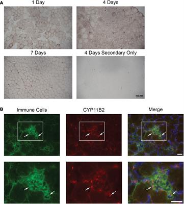 Mineralocorticoid Receptor Signaling Contributes to Normal Muscle Repair After Acute Injury